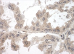 FNBP1L Antibody, Novus Biologicals 100 &mu;L | Buy Online | Novus Biologicals | Fisher Scientific
